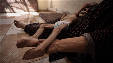 مجاعة غزة.. الكويت تطالب بمحاسبة إسرائيل على جرائمها بحق الإنسانية