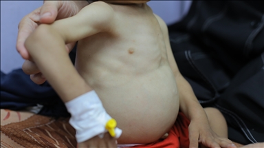 European countries, UN agencies reiterate calls for unimpeded aid after famine confirmed in Gaza