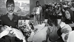 گرسنگی شدید در غزه؛ نوزاد 5 ماهه دیگری جان باخت