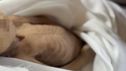 تجويع غزة.. وفاة الرضيعة راسيل أبو مسعود بسوء التغذية
