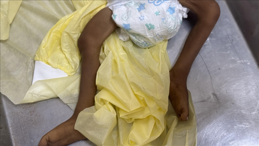 INTERVIEW – Situation in famine-ravaged Gaza ‘beyond catastrophe’: Doctors Without Borders