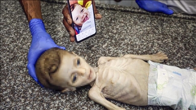 أطباء بلا حدود: الوضع في غزة "أسوأ من كارثي" 