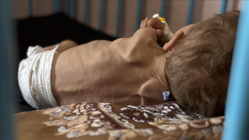 Rritet në 300 numri i të vdekurve nga uria në Rripin e Gazës, 117 prej tyre janë fëmijë 