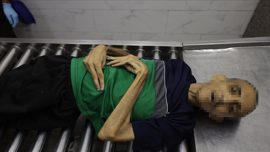 التجويع الإسرائيلي ينهي حياة الشاب حمادة الآغا في غزة