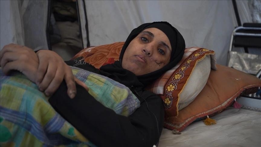 رملتها إسرائيل وشلتها.. منى كحيل ترعى أبناء مصابين وجياع بغزة (تقرير)