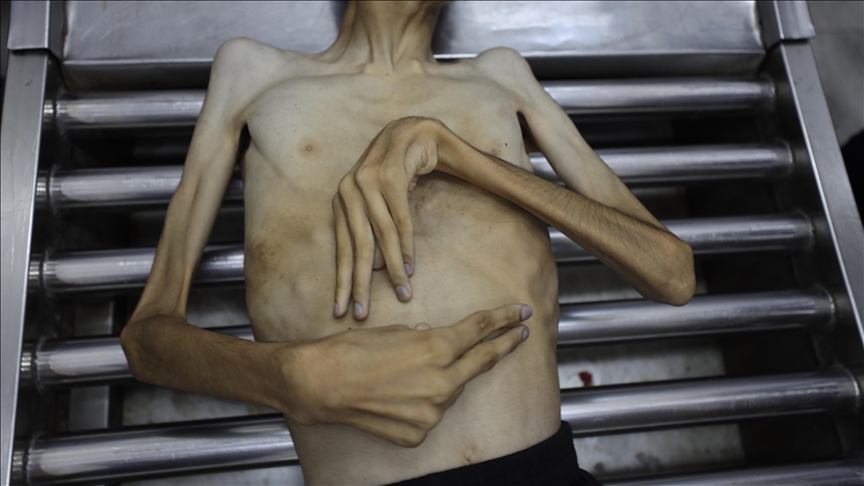 Le chef de l’UNRWA condamne le refus d’Israël de reconnaître la famine à Gaza comme « honteux »