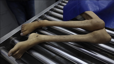 İsrail'in kıtlığı dayattığı Gazze'de son 24 saatte 3 kişi daha açlıktan hayatını kaybetti