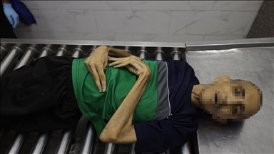 التجويع الإسرائيلي ينهي حياة الشاب حمادة الآغا في غزة