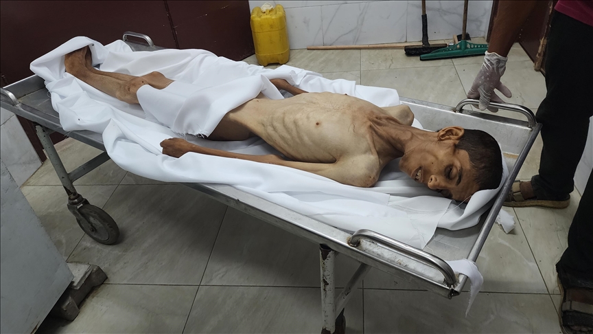 Gaza : cinq décès supplémentaires dus à la famine imposée par Israël