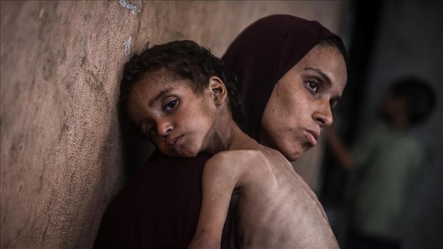 صحة غزة تعلن إصابة أعداد كبيرة من الفلسطينيين بأعراض مرض مجهول