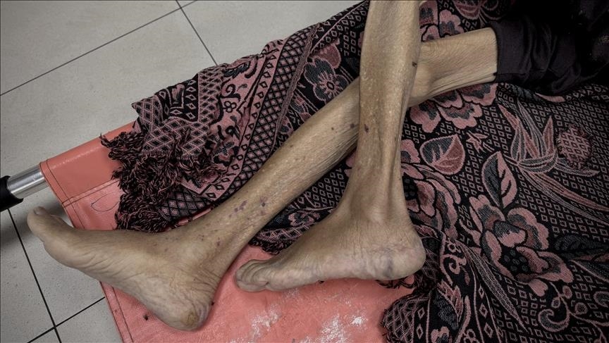 İsrail'in kıtlığı dayattığı Gazze'de son 24 saatte 3'ü çocuk 10 kişi daha açlıktan hayatını kaybetti