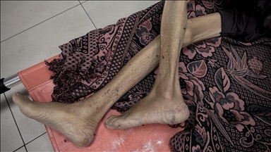  İsrail'in kıtlığı dayattığı Gazze'de son 24 saatte 3'ü çocuk 10 kişi daha açlıktan hayatını kaybetti