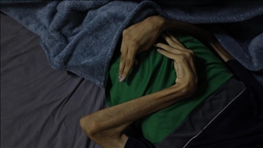 Gaza : la famine fait 10 morts supplémentaires sous blocus israélien