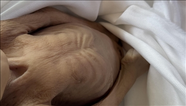Israeli starvation policy claims life of infant in Gaza