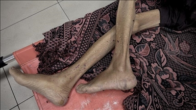 Li Xezeya ku Îsraîlê xela lê ferz kiriye, di 24 saetên dawîn da 3 jê zarok 10 kesên din jî ji birçîna mirin