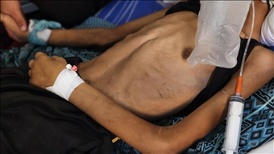 La famine tue 7 Palestiniens de plus dans la bande de Gaza sous blocus israélien