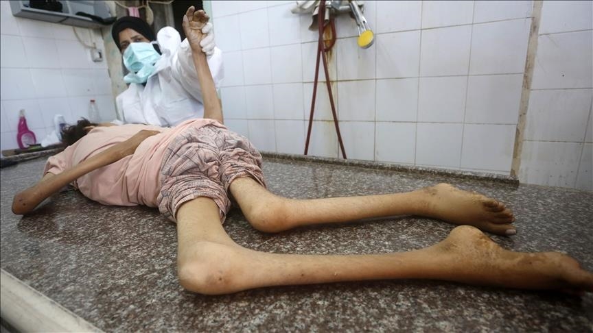 صحة غزة: وفاة 9 فلسطينيين منهم 3 أطفال نتيجة المجاعة
