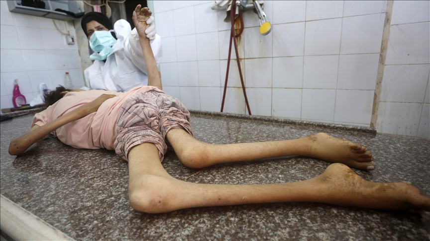 İsrail'in kıtlığı dayattığı Gazze'de son 24 saatte 3'ü çocuk 9 kişi daha açlıktan hayatını kaybetti