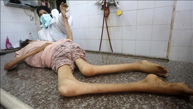 ادامه قحطی و گرسنگی در غزه؛ 9 فلسطینی دیگر از جمله 3 کودک جان باختند