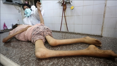 İsrail'in kıtlığı dayattığı Gazze'de son 24 saatte 3'ü çocuk 9 kişi daha açlıktan hayatını kaybetti