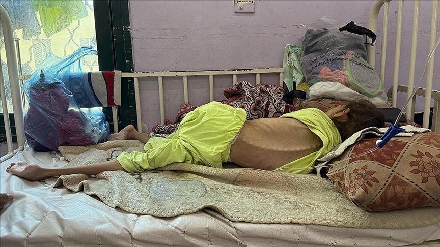 Li Xezeya ku Îsraîlê xela lê rakiriye di 24 saetên dawîn da 3 kesên din jî ji birçîna mirin