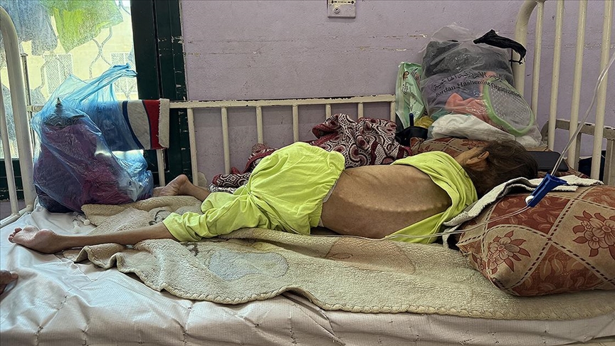 İsrail'in kıtlığı dayattığı Gazze'de son 24 saatte 3 kişi daha açlıktan hayatını kaybetti