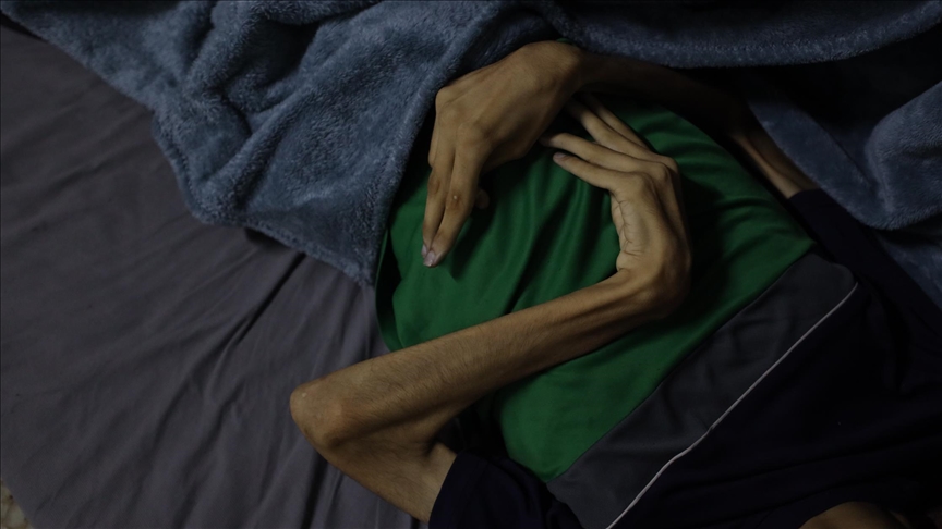 غزة.. ارتفاع حصيلة وفيات التجويع الإسرائيلي إلى 376 فلسطينيا