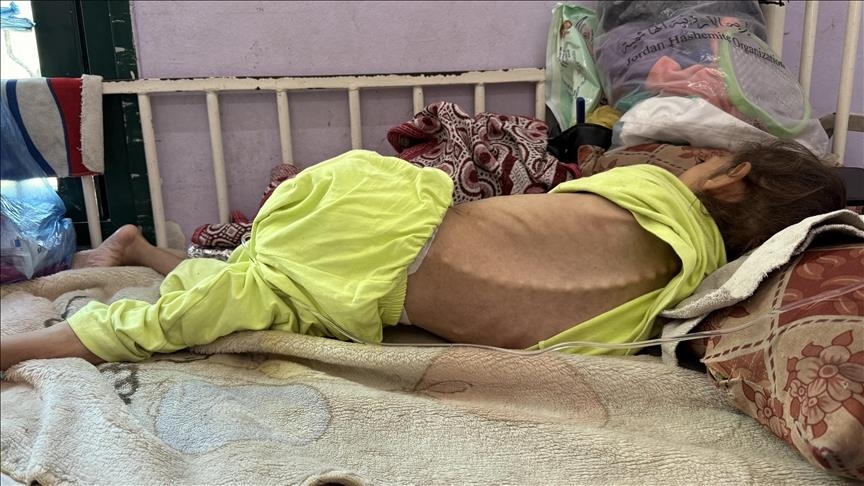 OBSH-ja bën thirrje për dërgesa gjithëpërfshirëse dhe të qëndrueshme të ushqimit dhe ilaçeve në Gaza