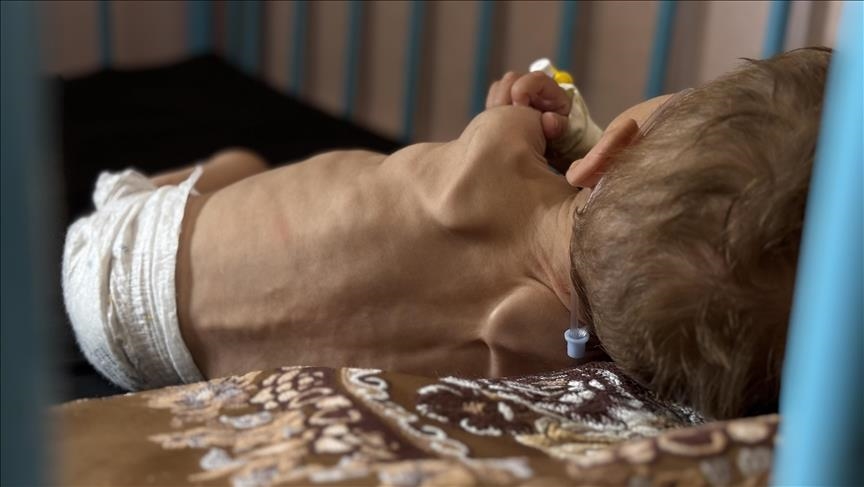 Pesë palestinezë të tjerë vdesin nga uria në Gaza, shifra e përgjithshme rritet në 387