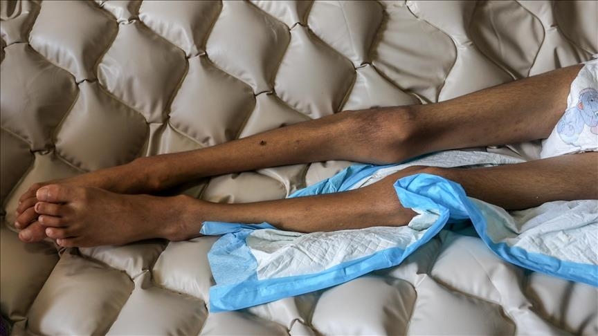 6 more Palestinians die of starvation in Israel-besieged Gaza