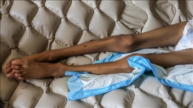 Gaza death toll from Israeli war passes 64,500 as 6 more die of starvation