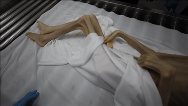 6 more die of starvation in famine-ravaged Gaza, bringing death toll to 399