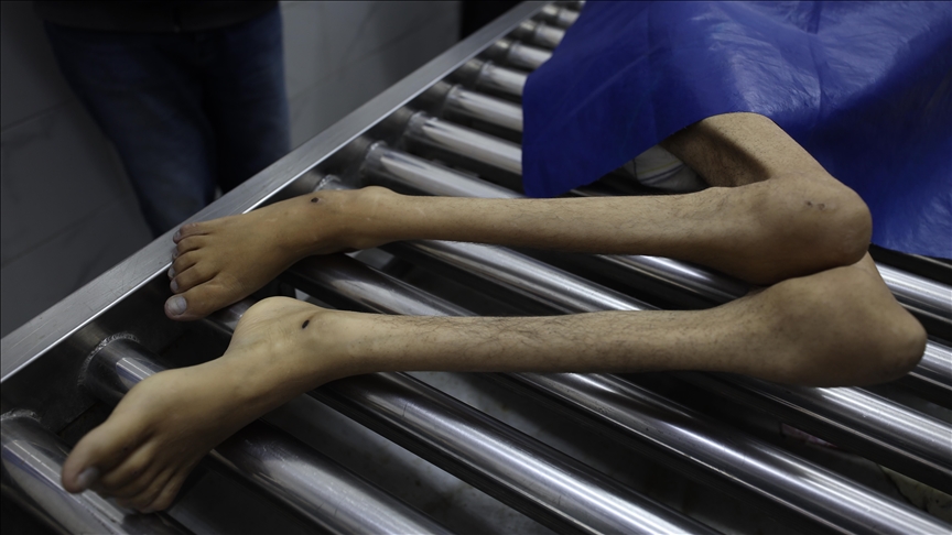 Još petero Palestinaca umrlo od gladi u Gazi