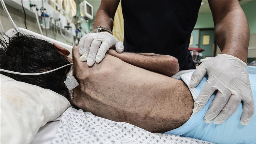 İsrail'in kıtlığı dayattığı Gazze'de son 24 saatte 5 kişi daha açlıktan hayatını kaybetti