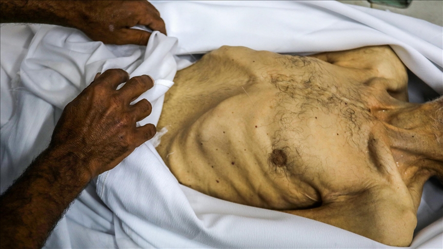 İsrail'in kıtlığı dayattığı Gazze'de son 24 saatte 7 kişi daha açlıktan hayatını kaybetti