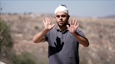 الضفة.. مستوطنون إسرائيليون يعتدون على فلسطيني معاق في رام الله