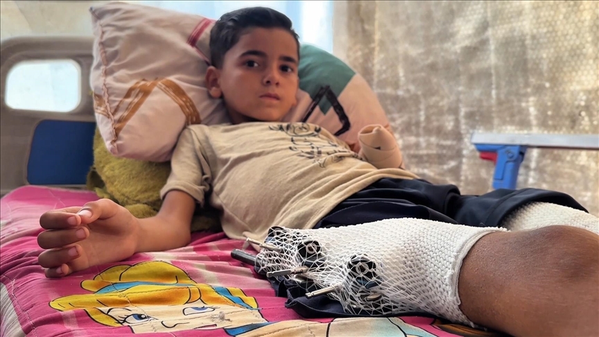 İsrail'in Gazze'de oyun oynarken hedef aldığı küçük Esed iyileşip yeniden "çocuk olmak" istiyor
