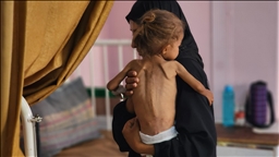 أطباء بلا حدود: وصلنا لأسوأ وضع إنساني يمكن تصوره بغزة