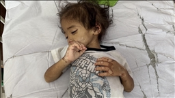Vogëlushi nga Gaza në luftë për mbijetesë për shkak të urisë së imponuar nga Izraeli