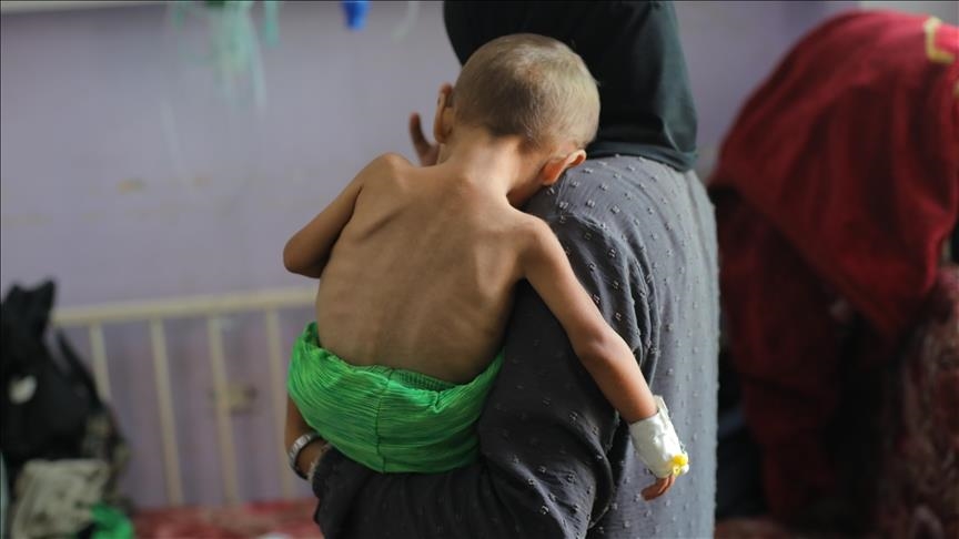 غزة.. ارتفاع وفيات التجويع الإسرائيلي إلى 422 بينهم 145 طفلا