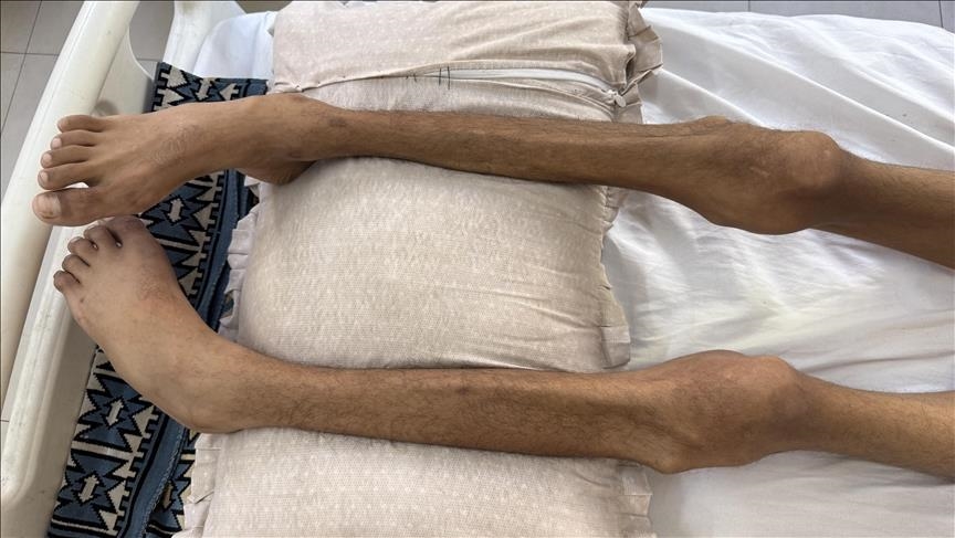 طی یک روز 2 فلسطینی دیگر در غزه بر اثر گرسنگی جان باختند