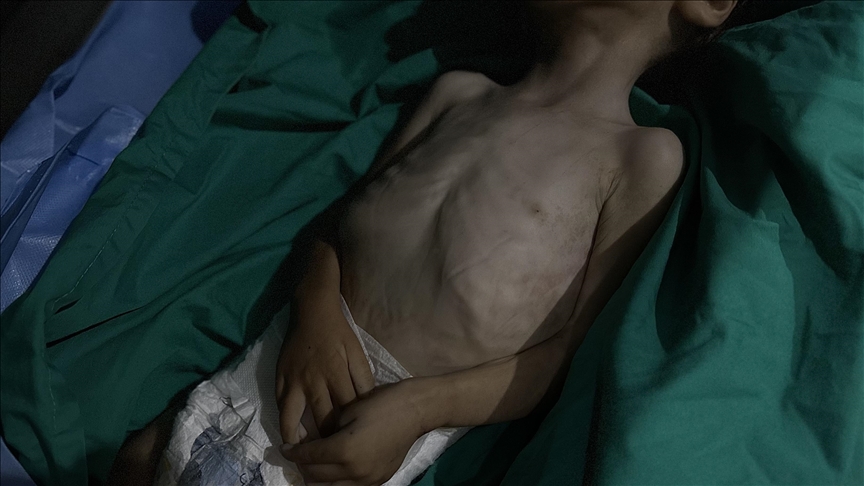 Gaza death toll nears 65,000 as hunger deaths climb to 428