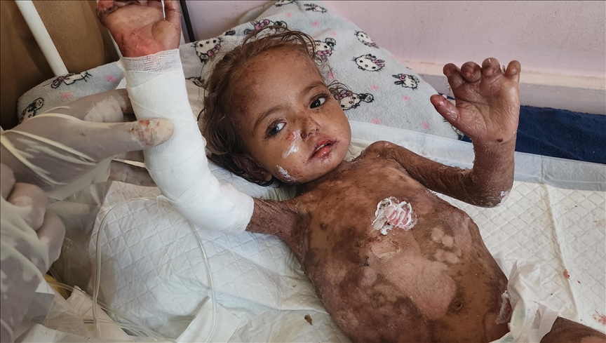 E bllokuar midis urisë dhe sëmundjes, vogëlushja nga Gaza lufton për mbijetesë