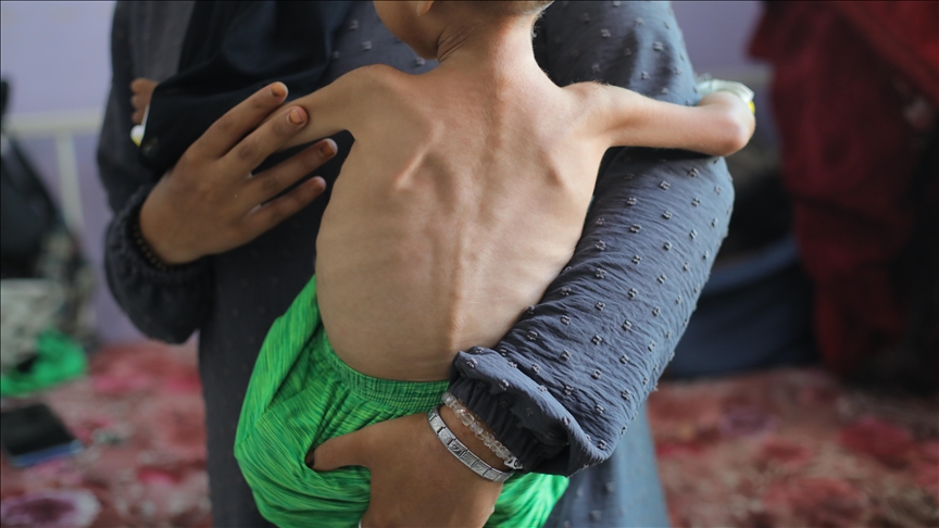 UN says efforts to 'support starving people are being systematically blocked' by Israel in Gaza