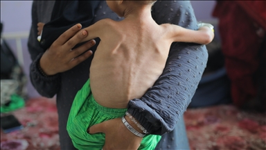 UN says efforts to 'support starving people are being systematically blocked' by Israel in Gaza