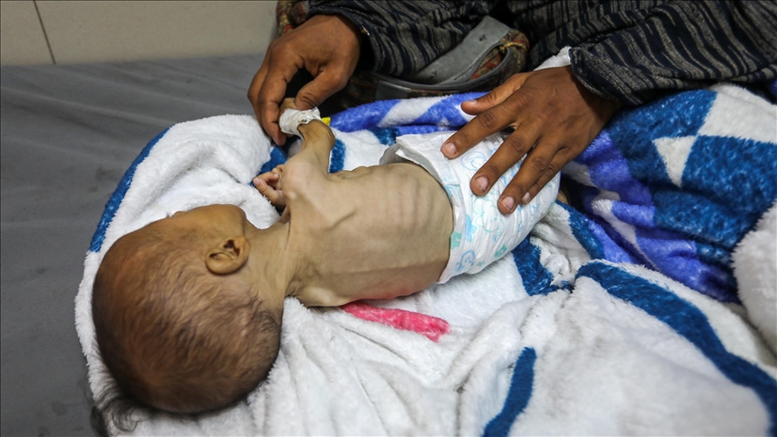 سازمان ملل: یک سوم از کودکان زیر 3 سال در غزه گرسنه هستند