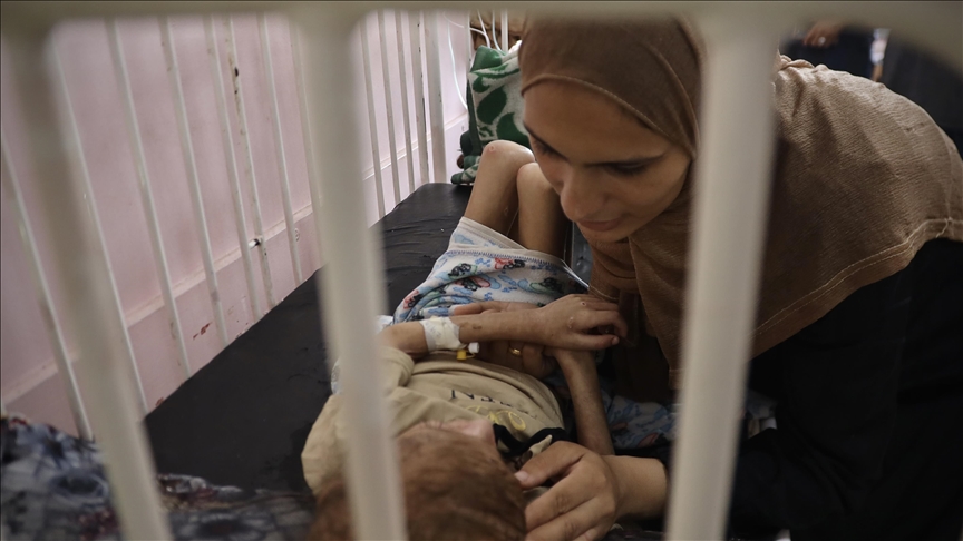 الطفلة مي.. "وردة" أذوى التجويع الإسرائيلي جسدها بغزة (تقرير)