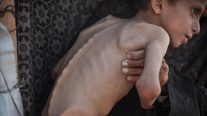 Gaza : 453 personnes tuées par la famine à Gaza, sous blocus israélien