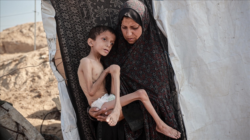 Kematian kebuluran Gaza cecah 453, termasuk 150 kanak-kanak Kematian kebuluran Gaza cecah 453, termasuk 150 kanak-kanak