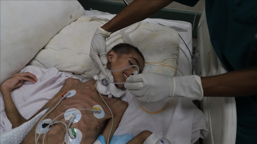 Palestine: 15 enfants transportés vers l’Italie pour soins médicaux